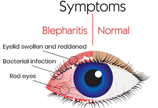 Why choose us for eye surgery
