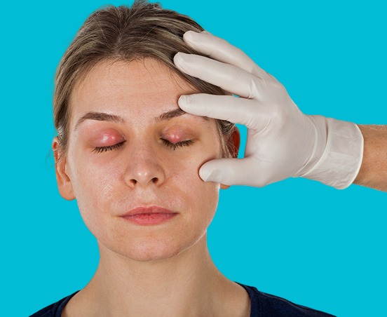 Cataract Eye Surgery 